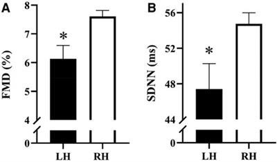 Evidence of increased cardiovascular disease risk in left-handed individuals